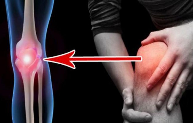 артрит коленного сустава