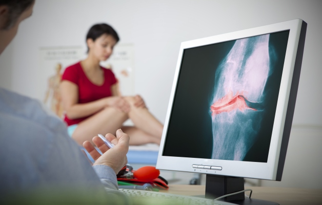диагностика артроза коленного сустава