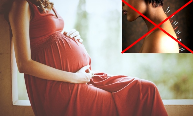 лечить беременных иглоукалыванием запрещено
