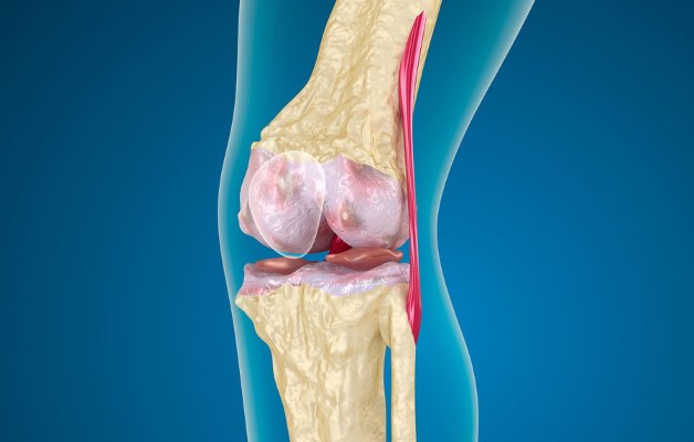сустав колена пораженный артрозом