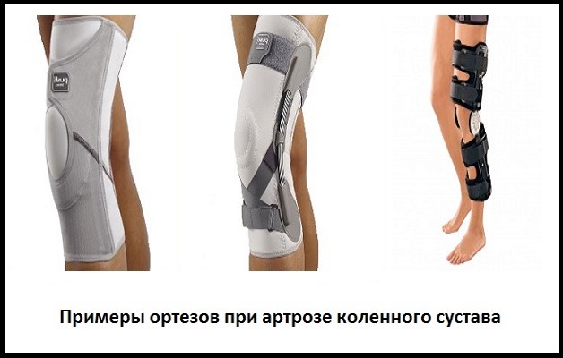 Артроз коленного сустава можно носить наколенники thumbnail