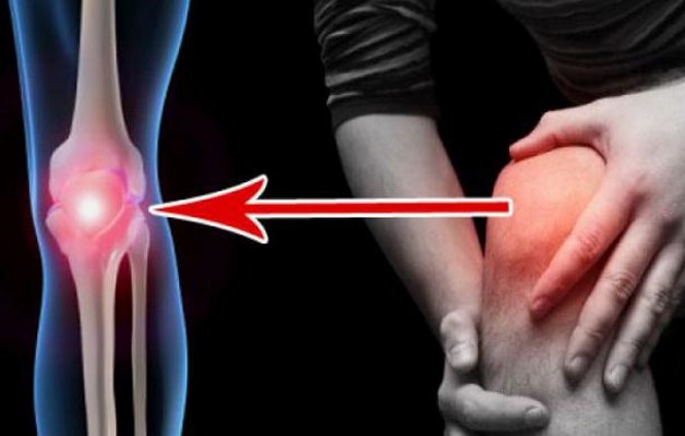 Средства для лечения артрита коленного сустава thumbnail