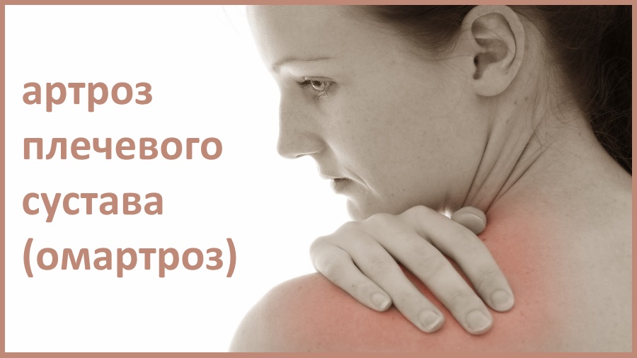 Артроз плечевого сустава: клиническая картина, степени и профилактика ...