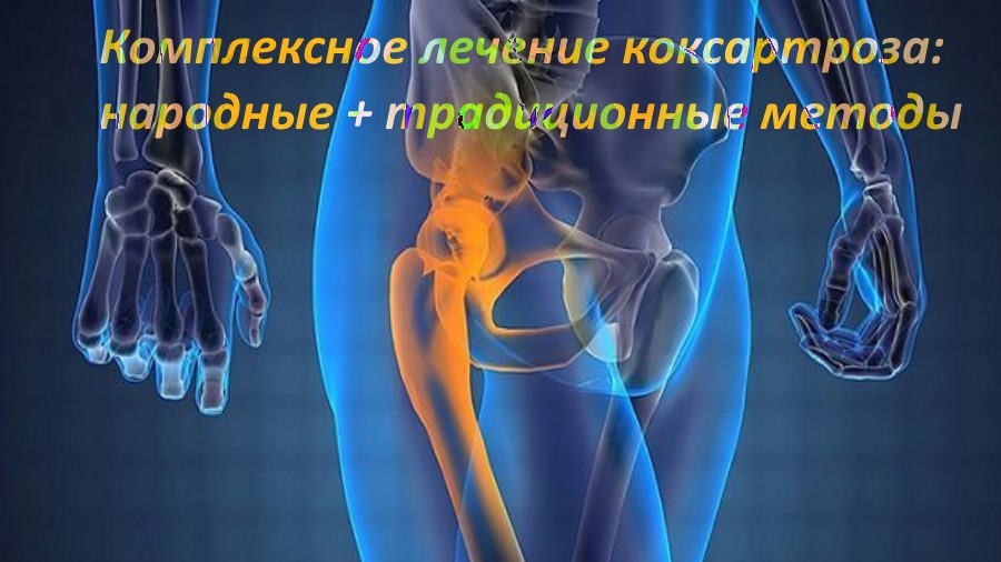Лечение артроза народными средствами. Артроз суставов - методы лечения народными средствами 🤒 Воспаление локтевого сустава причины лечение 👍 Лечить артроз колена. Народные средства для лечения артроза коленного сустава