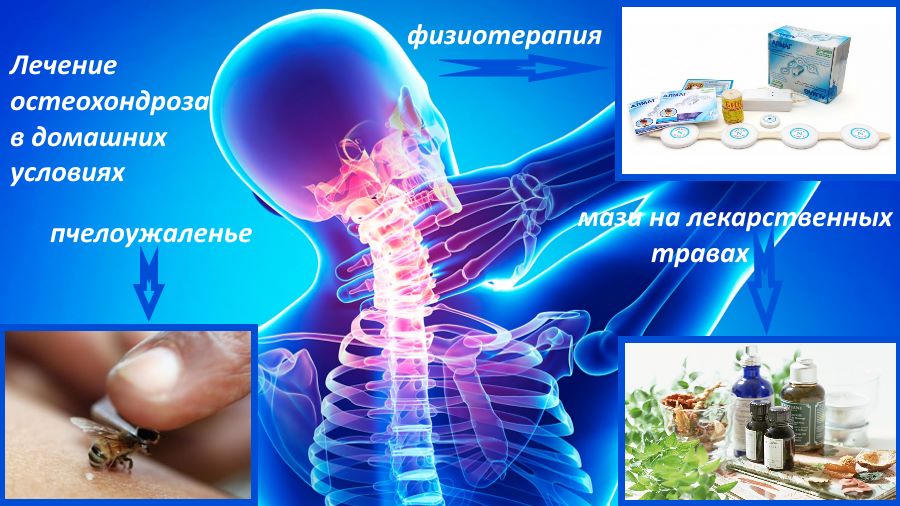 Методы лечения остеохондроза. Остеохондроз лечение. Лечим остеохондроз в домашних условиях. Комплексная терапия при остеохондрозе.