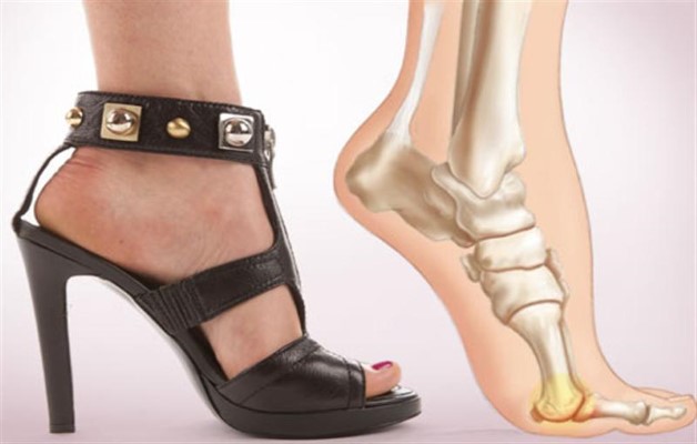 Изображение - Лечение суставов пальцев стопы ног lecheniya-artrita-palcev-nog