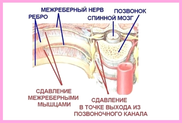 Остеохондроз грудного отдела позвоночника упражнения бубновского thumbnail