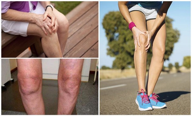 Деформация коленных суставов причина и лечение thumbnail