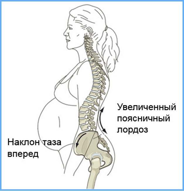 Хондроз поясничного отдела позвоночника симптомы лечение у беременных thumbnail