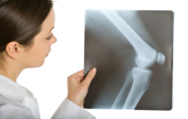Изображение - Гнойный артрит коленного сустава лечение rentgen-kolena