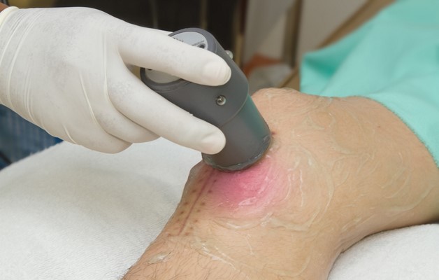 Физиотерапевтические процедуры при артрозе коленного сустава thumbnail